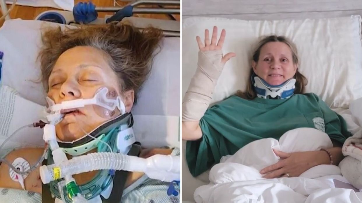 Mulher sobrevive a acidente após hemorragia cerebral: “Deus tem um plano”