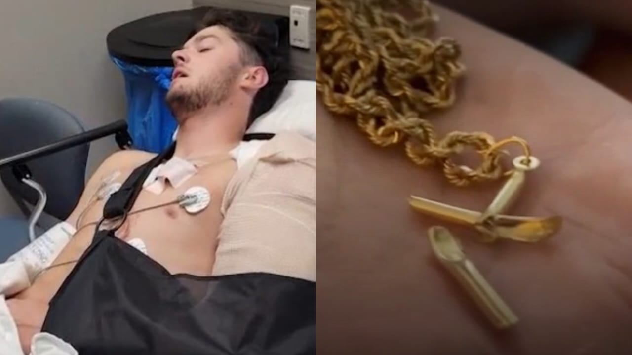 Jovem sobrevive a tiro após bala atingir colar de cruz: "Deus é a razão de eu estar vivo"