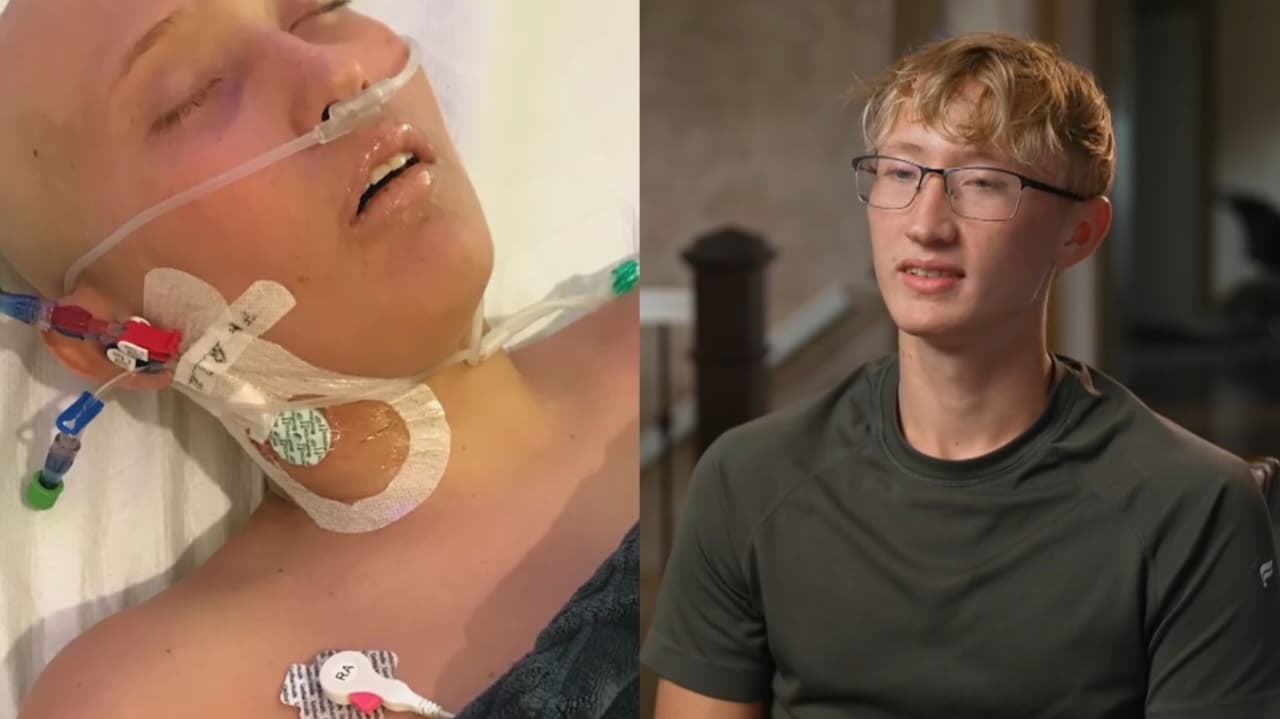 Adolescente é curado de leucemia e câncer no cérebro após orações dos pais: ‘Deus fez’