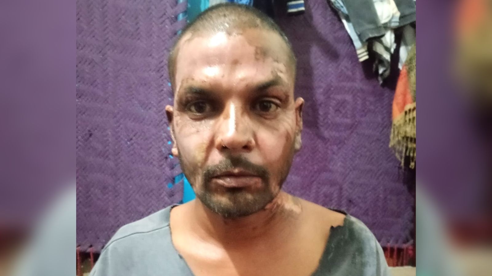 Cristão é incendiado por muçulmano no Paquistão 