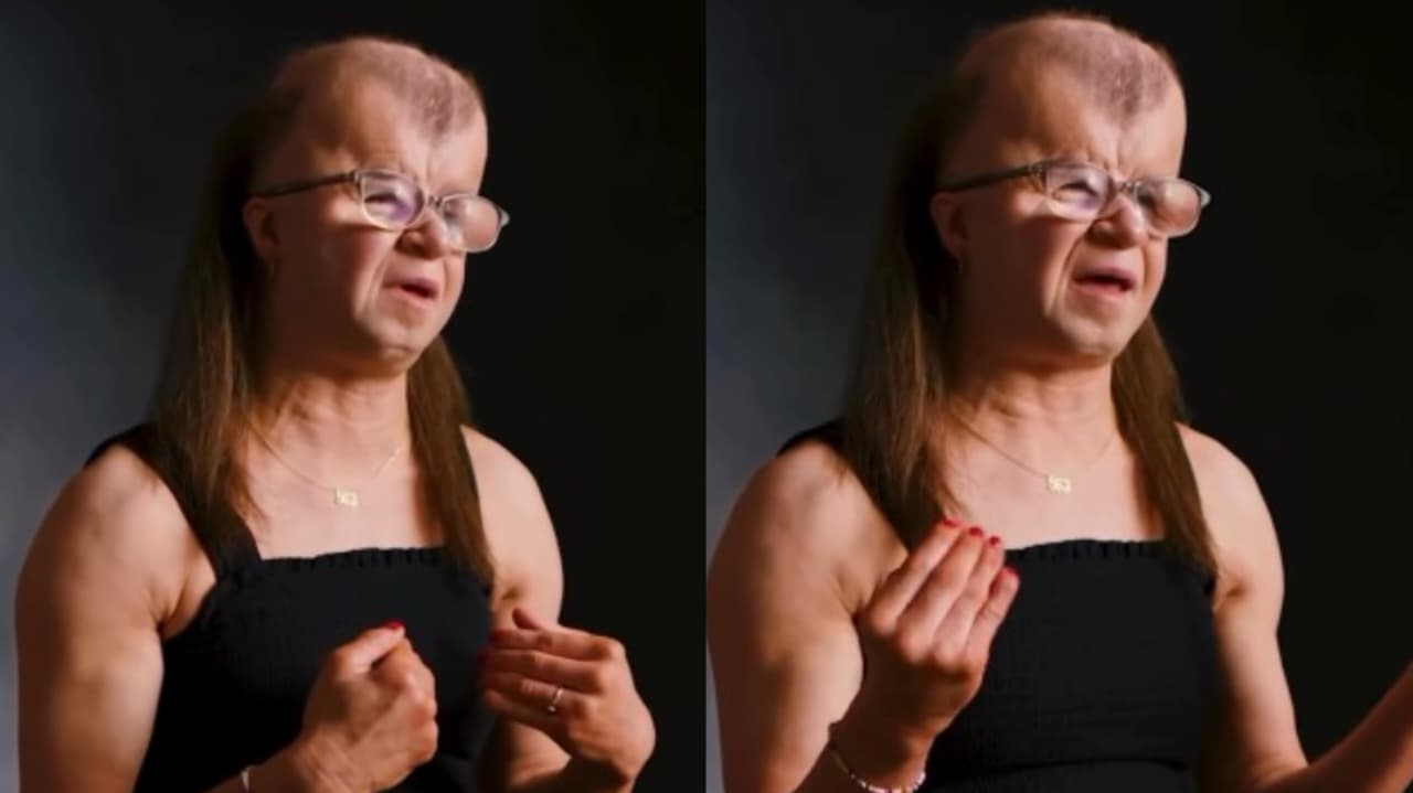 Mulher com síndrome que causa morte precoce testemunha: “Vivo cada dia como uma bênção”