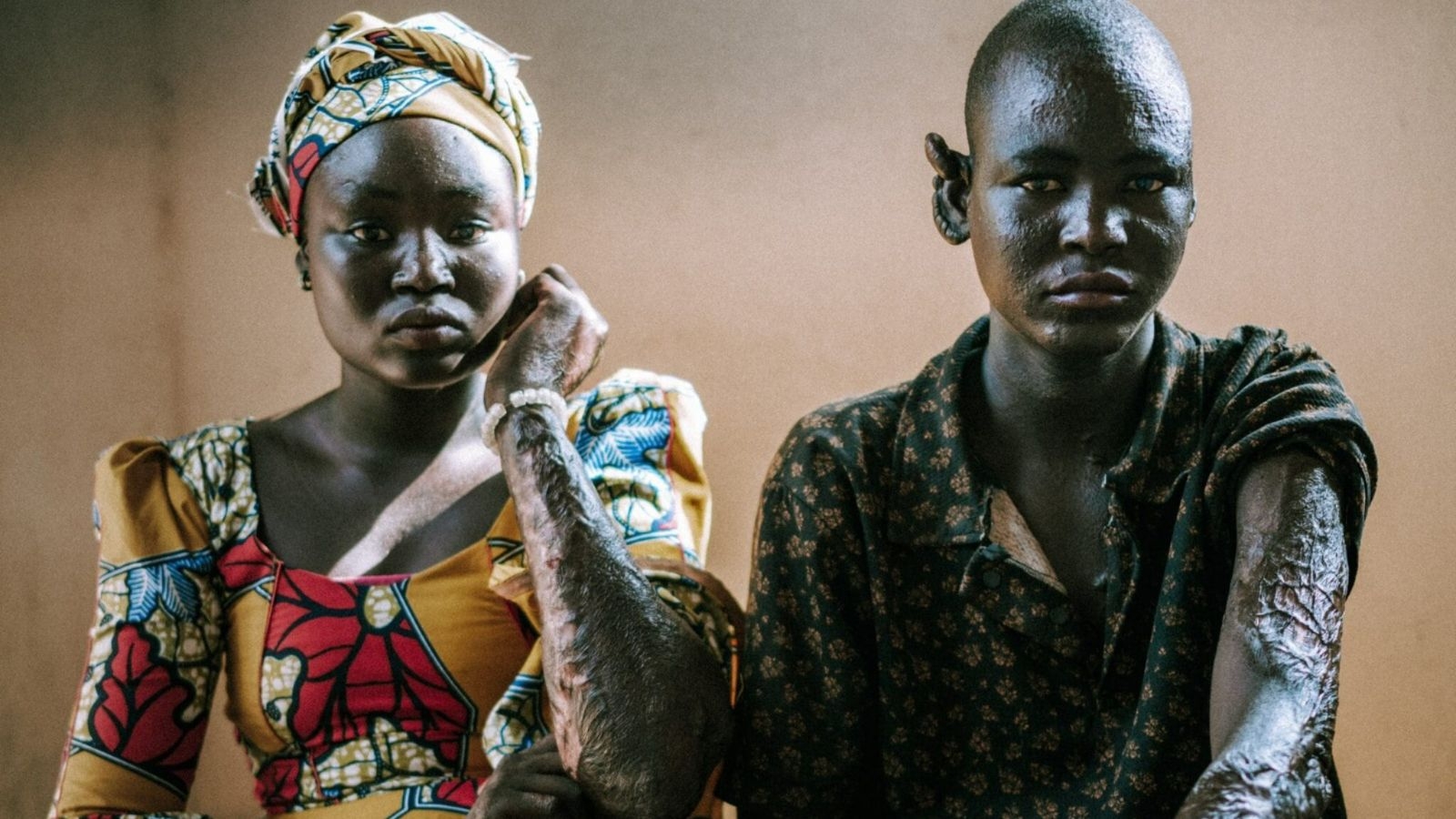 Após perderem a família em ataque do Boko Haram, órfãos relatam: ‘Deus mandou perdoar’”