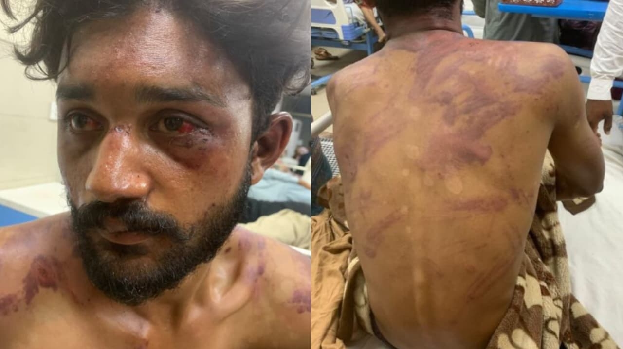 Jovem cristão é espancado após proteger menina cristã de assédio no Paquistão